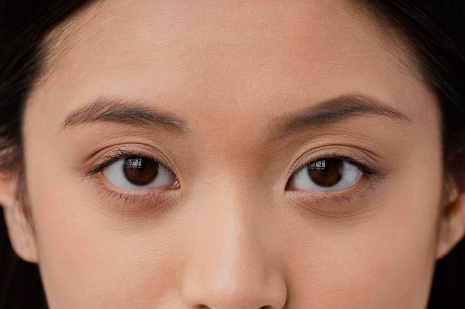 一名女子的雙眼，眼下有明顯的黑眼圈。